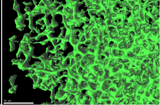 Collegamento a Studio svela il disegno architettonico delle metastasi del cancro